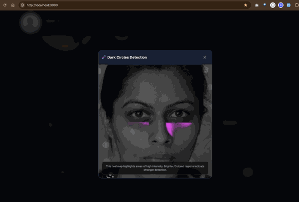Dark Circle Detection