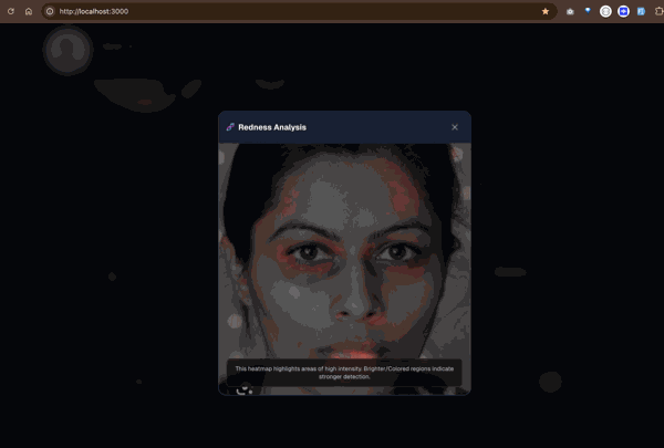 Redness Detection